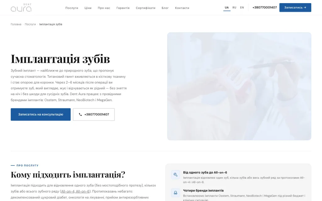 Сторінка послуги: імплантація